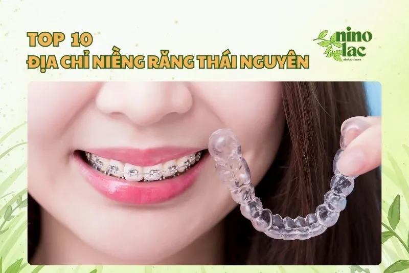 Top 10 địa chỉ niềng răng Thái Nguyên uy tín